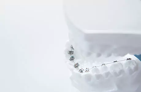 矯正歯科